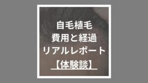 自毛植毛費用と経過 リアルレポート