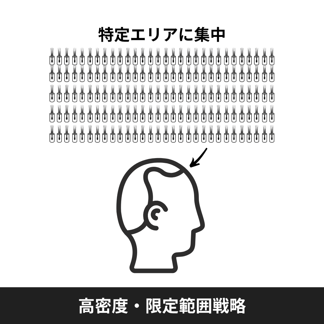 自毛植毛の高密度・限定範囲戦略