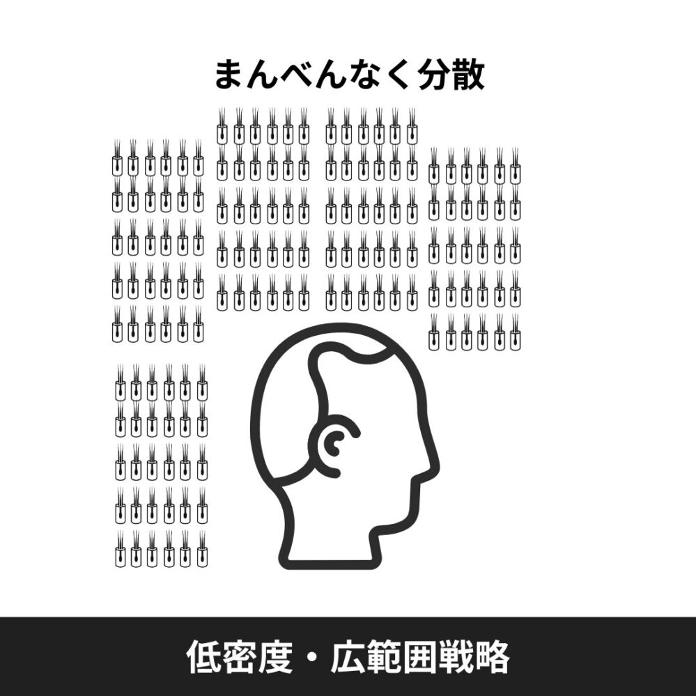 自毛植毛の低密度・広範囲戦略