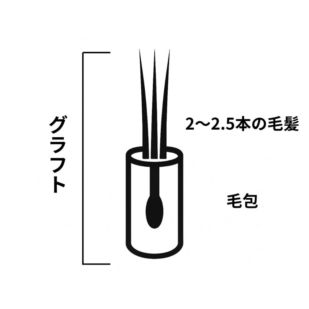 自毛植毛のグラフトとは何か
