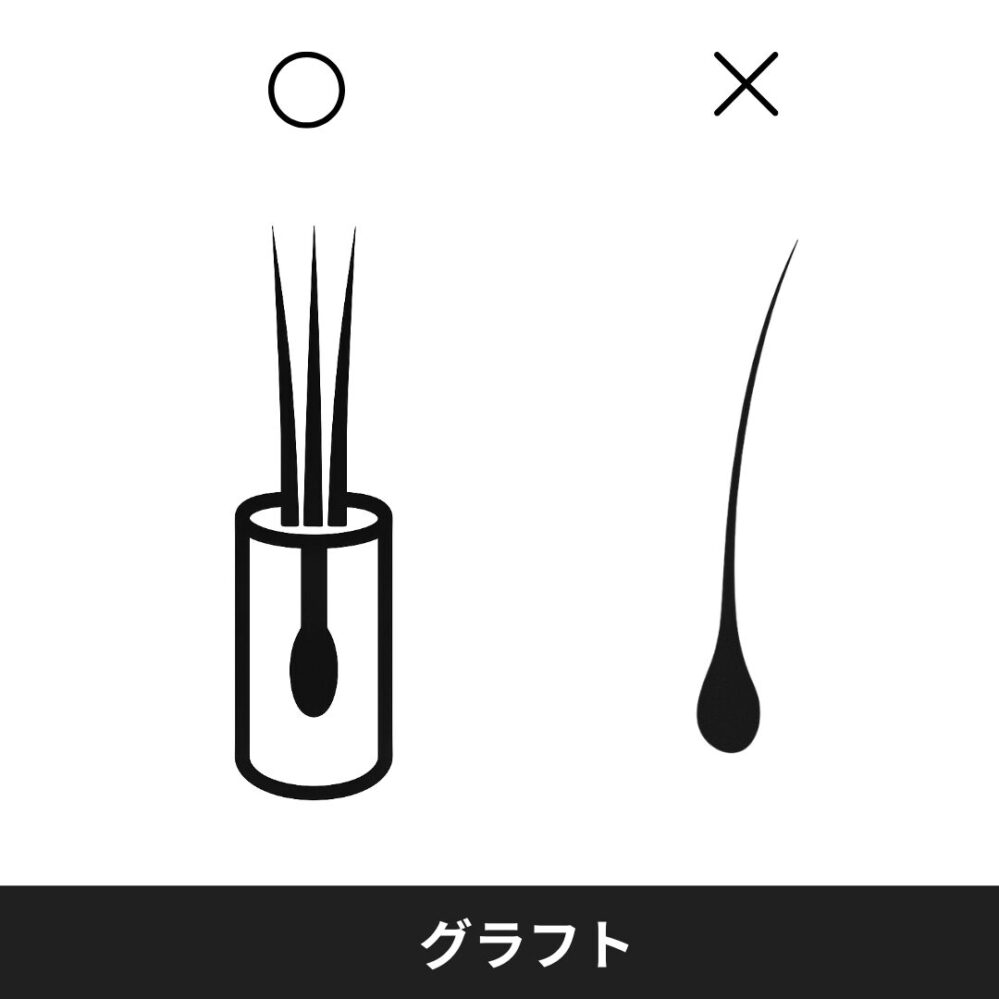 自毛植毛のグラフトの説明