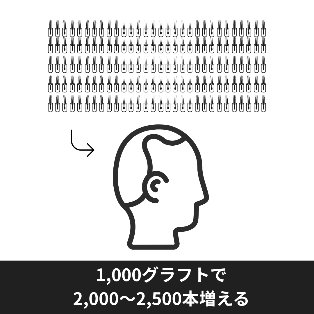 自毛植毛は毛髪数が見た目を左右する