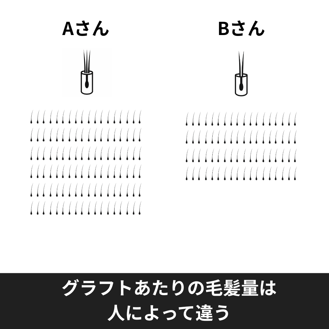 グラフトあたりの毛髪量は人によって違う